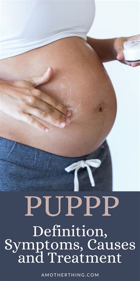 PUPPP Rash: Definition, Symptoms, Causes, & Treatment