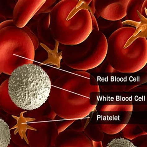 Blood Cancer Types: Leukemia, Lymphomas, Myelomas, and More