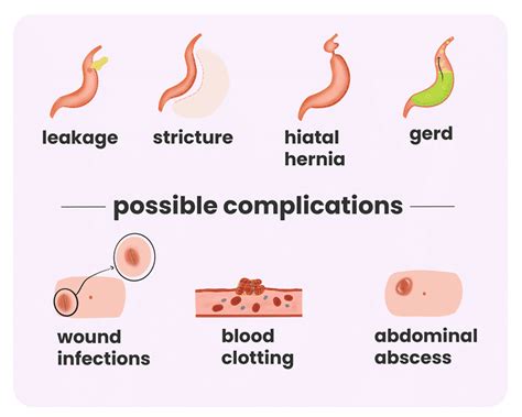 Gastric sleeve complications: Causes, treatments and prevention