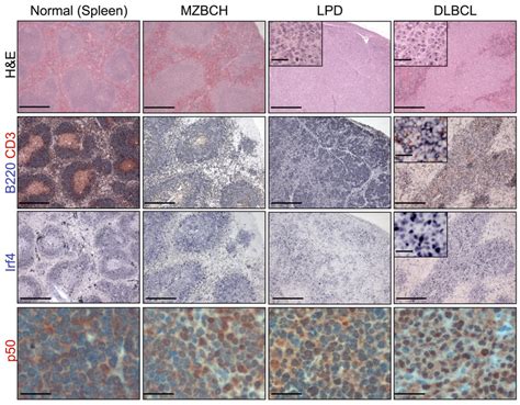 Blimp1 B cell conditional knockout mice develop DLBCL with an activated ...