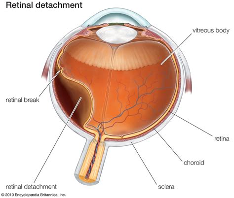 Vitreous body | anatomy | Britannica