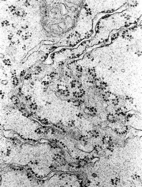 Ribosomes Electron Micrograph