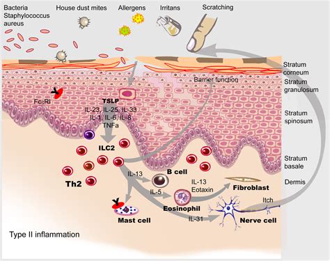 Management of dupilumab-associated ocular surface diseases in atopic ...