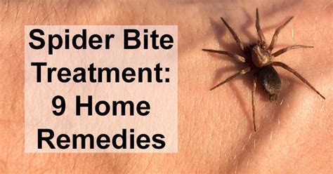 Spider Bite Treatment: 9 Home Remedies - DavidWolfe.com