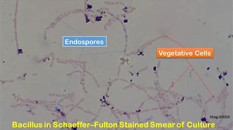 Endospore Stain: Introduction, Principle, Requirements, Procedure, Result