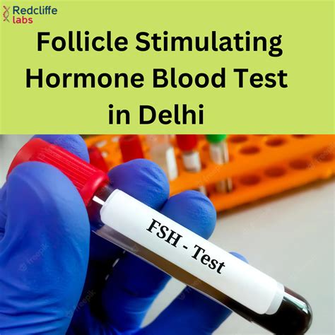 Follicle Stimulating Hormone FSH Test in Delhi - Redcliffe Labs ...