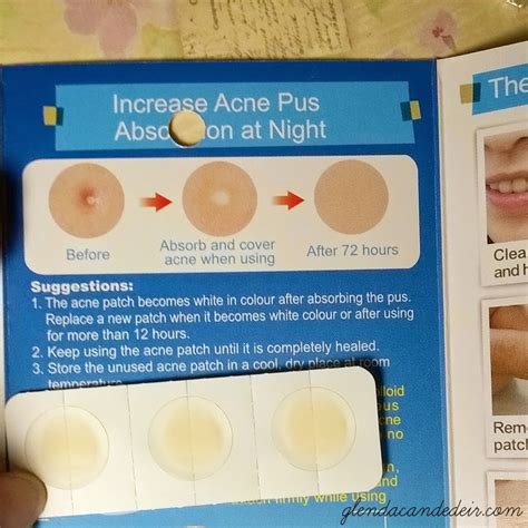 How Do Zit Stickers Work - Lavanya krishnan, a board ensured ...