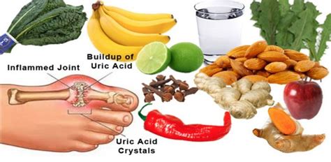 DIET CHART FOR ELEVATED URIC ACID LEVELS - Dr.Dugad