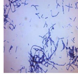 Bacillus cereus on gram stain (100X) | Download Scientific Diagram