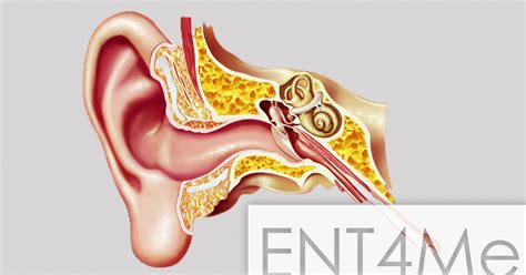 How To Doctors Drain Ears - Best Drain Photos Primagem.Org