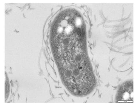 Difference Between Nitrosomonas and Nitrobacter | Compare the ...