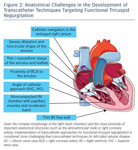 Figure 2: Anatomical Challenges in the Development of Transcatheter ...