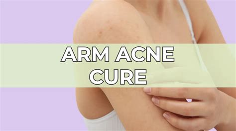 Unveiling the Mystery of Arm Acne: Causes and Effective Treatments – Aqneeq