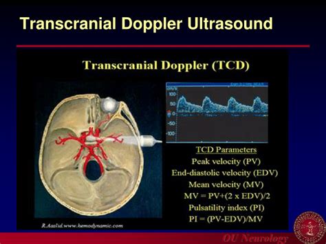 PPT - Introduction to Carotid Ultrasound and Transcranial Doppler ...