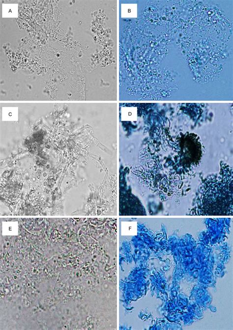 Fungal smears under light microscope. A-F: Fungal smears under light ...