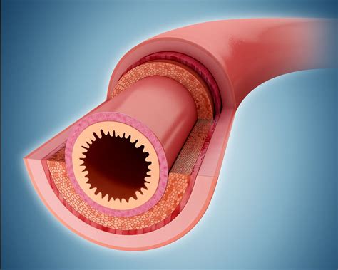 The Narrowing of Lumen in the Intestines