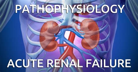 Pathophysiology of Acute Renal Failure simplified - Save now, pin later ...