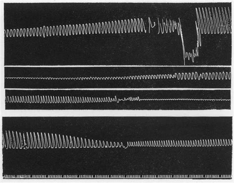 Figure 2 from Some further Experiments on the Physiology of the Allyl ...