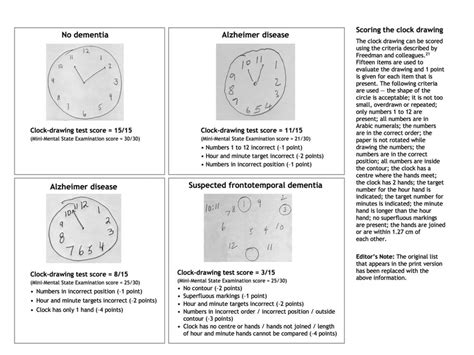 Dementia Clock Drawing at PaintingValley.com | Explore collection of ...