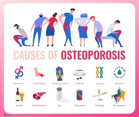 OSTEOPOROSIS - Symptoms, Causes, Risk Groups, Prevention and Treatment ...