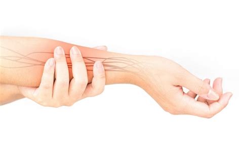 10 Facts About Ulnar Nerve Entrapment - Facty Health