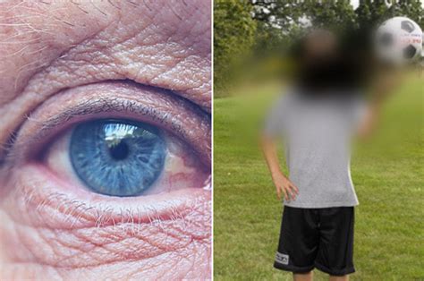 Macular Degeneration: Symptoms, Causes, and Treatment | College Review ...