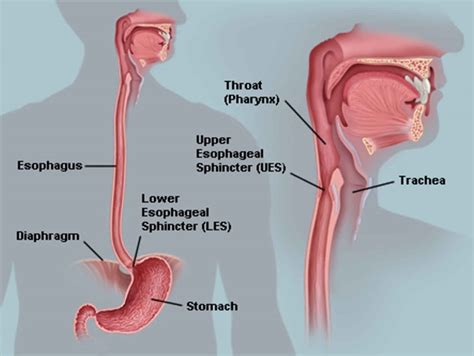 Esophageal dysmotility, esophageal motility disorder, causes, symptoms ...