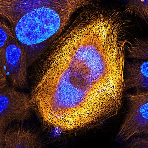 Immortalized human skin cells expressing fluorescently tagged keratin ...