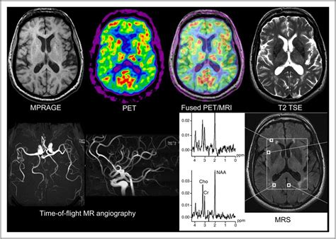 What Is An Mri Scan For Dogs