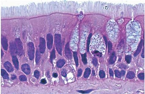 Pseudostratified Columnar Epithelium Histology - Jotscroll