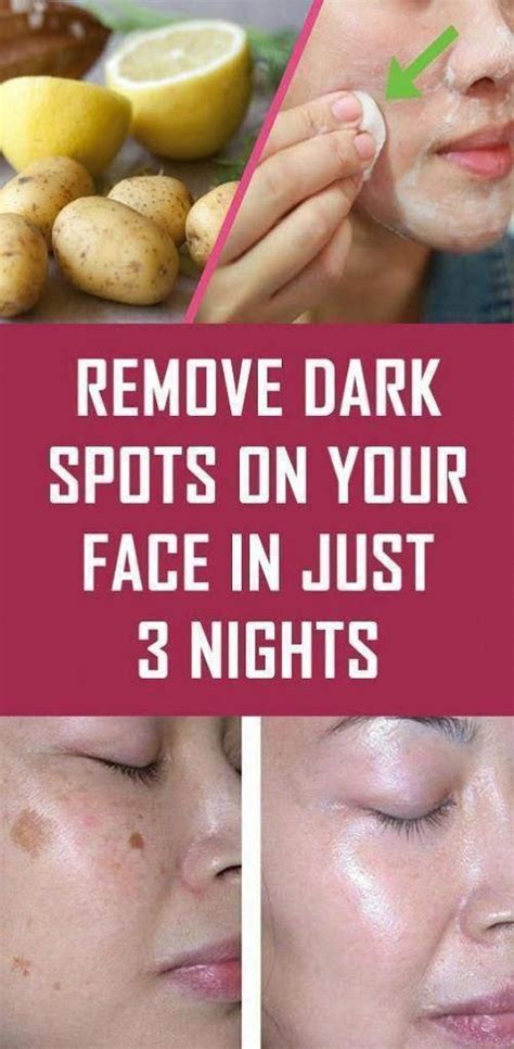 Ways to get Rid Of Black Spots on Face #BrownSpotsBetweenTeeth # ...