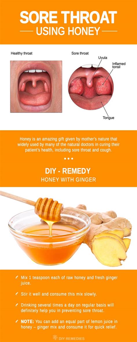 How to Get Rid of Sore Throat using Honey