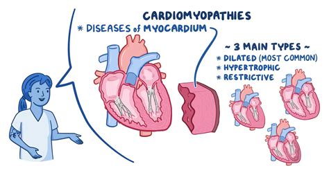 Cardiomyopathy: Nursing - Osmosis Video Library