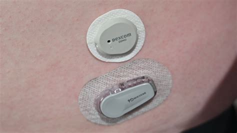 First look: New Dexcom G7 glucose monitor | AppleInsider