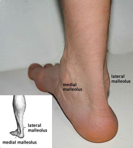 Lateral Malleolus Pictures to Pin on Pinterest - PinsDaddy