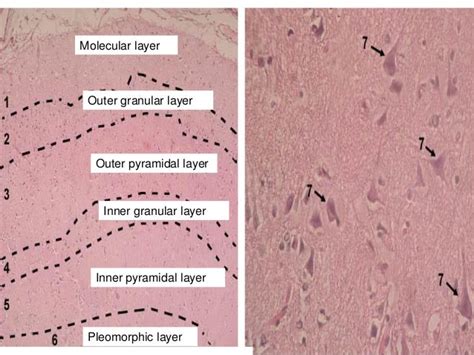 Histology of cerebrum and cerebellum