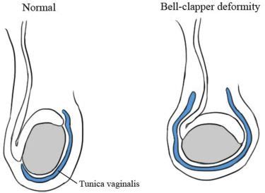 41 best Sexual and Reproductive Health images on Pinterest | Surgery ...