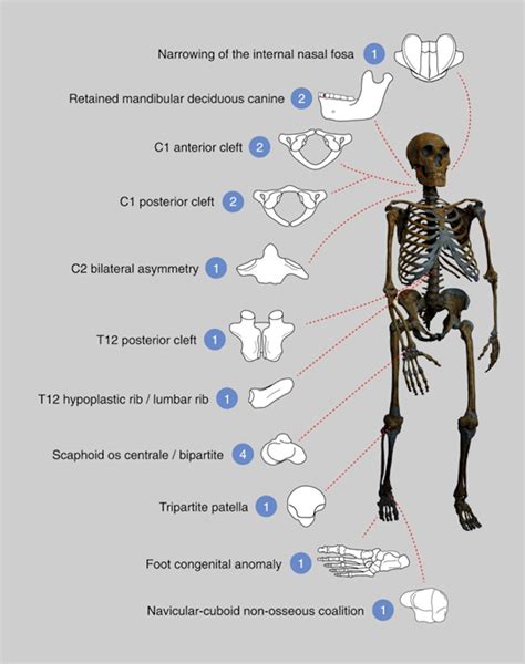 Did Inbreeding Kill the Neanderthals? Experts Say Skeletons Hold Clues ...