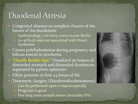 PPT - Neonatal Bilious Emesis PowerPoint Presentation, free download ...