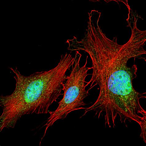 Immunofluorescence Troubleshooting | Tips & Tricks