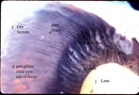 ANATOMY OF THE HUMAN EYE: Lens Zonule Gross Features