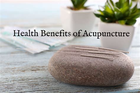 Health Benefits of Acupuncture