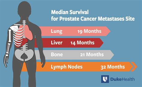 Cancer De Huesos Metastasis - SEO POSITIVO