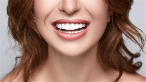 How to Get a Healthy Snow-white Smile With Veneers - The Frisky