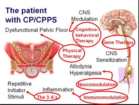 Chronic Pelvic Pain Syndrome. Causes, symptoms, treatment Chronic ...