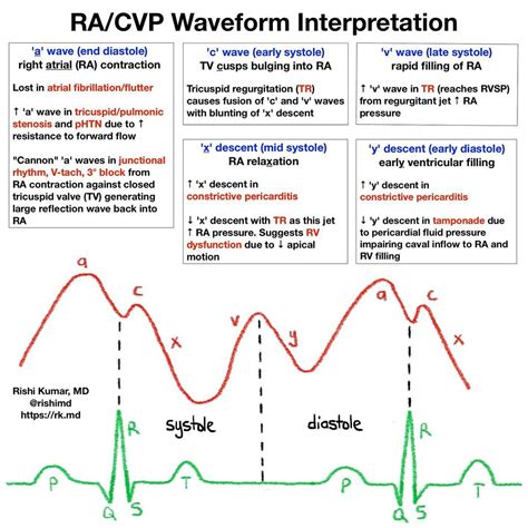 Art Line Waveform Explanation - Get More Anythink's