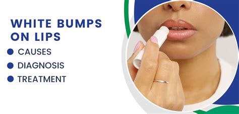 White Bumps on Lips: Causes, Diagnosis, and Treatment