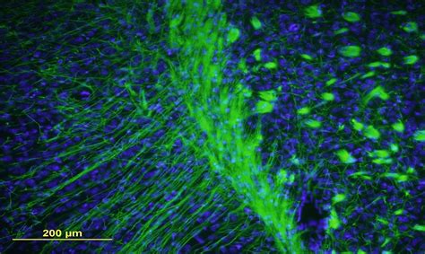 Immunofluorescence staining - Glial cells laboratory | School of Medicine