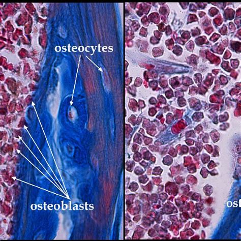 Bone cells-osteoblasts, osteocytes and osteoclasts; unpublished image ...