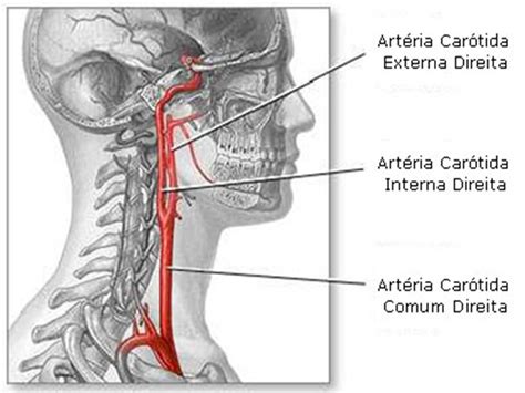 Doença das artérias carótidas • Clínica Médica Urovascular